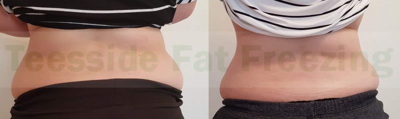 Muffin top before and 8 weeks after
