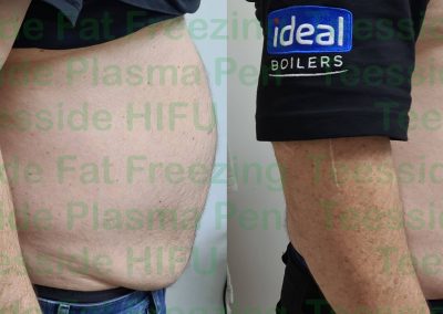 male belly buster before and after
